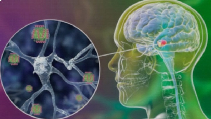  La scoperta del gene responsabile della malattia di Parkinson: un passo avanti nella lotta contro la malattia